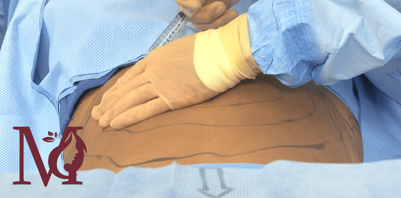 The 5 Best Tummy Tuck Clinics in Singapore Homepage