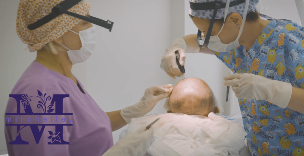 Top 5 Hair Transplant Clinics in Singapore Homepage