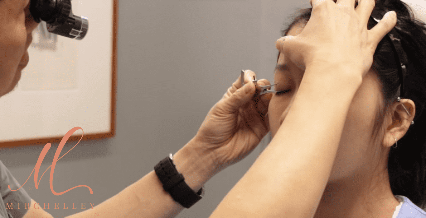 Top 5 Double Eyelid Surgery Clinics in Singapore Homepage