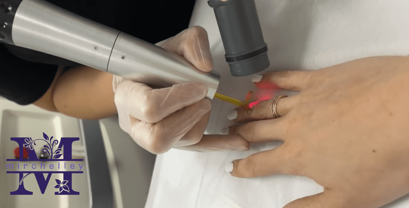 The 5 Best Tattoo Removal Clinics in Singapore Homepage