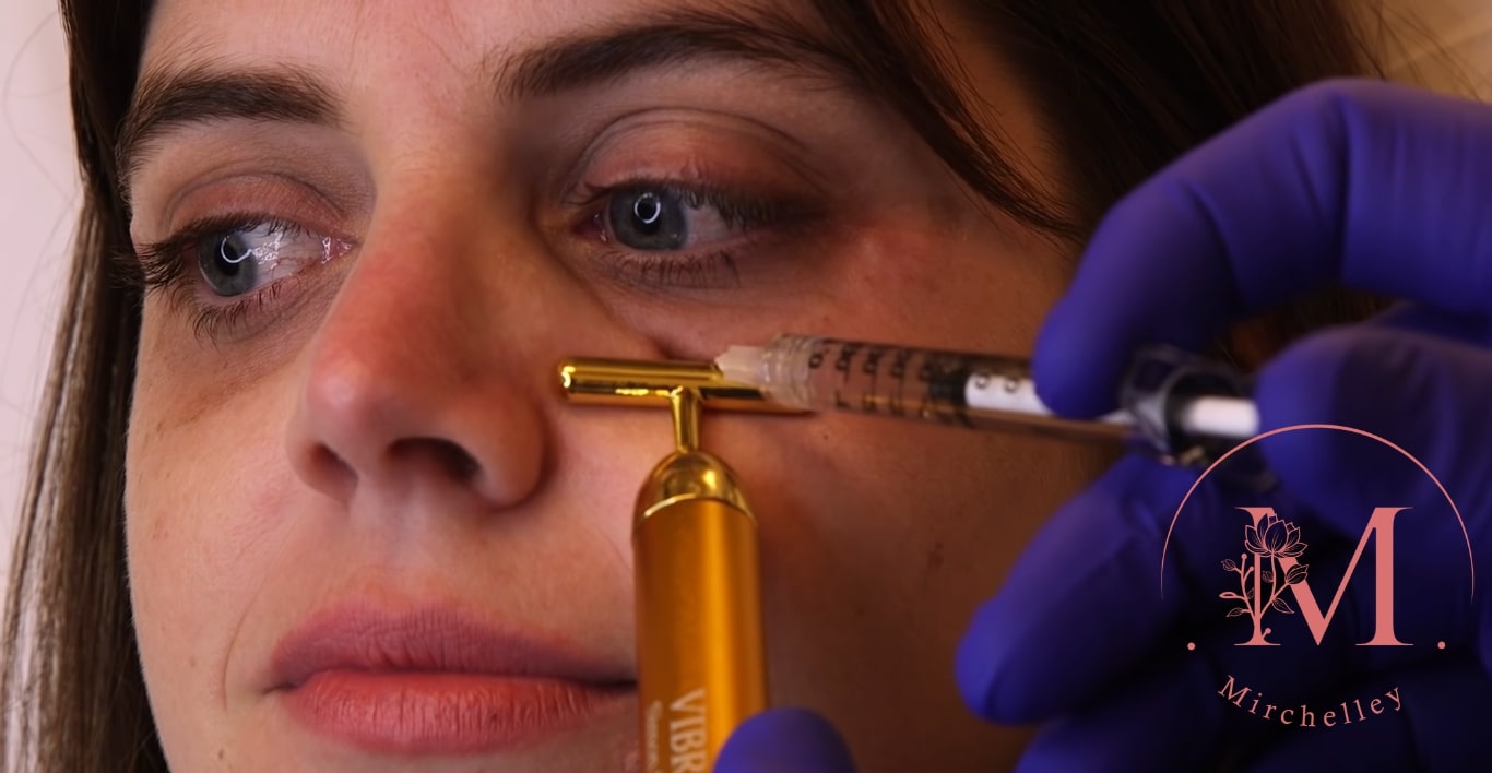 The 5 Best Clinics for Dark Eye Circle Treatments in Singapore