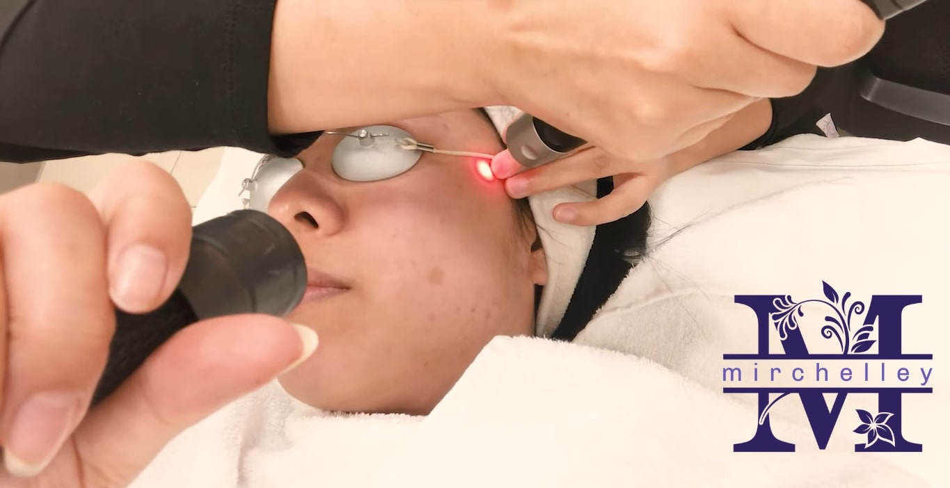 Top 5 Clinics for Pigmentation Treatments in Singapore