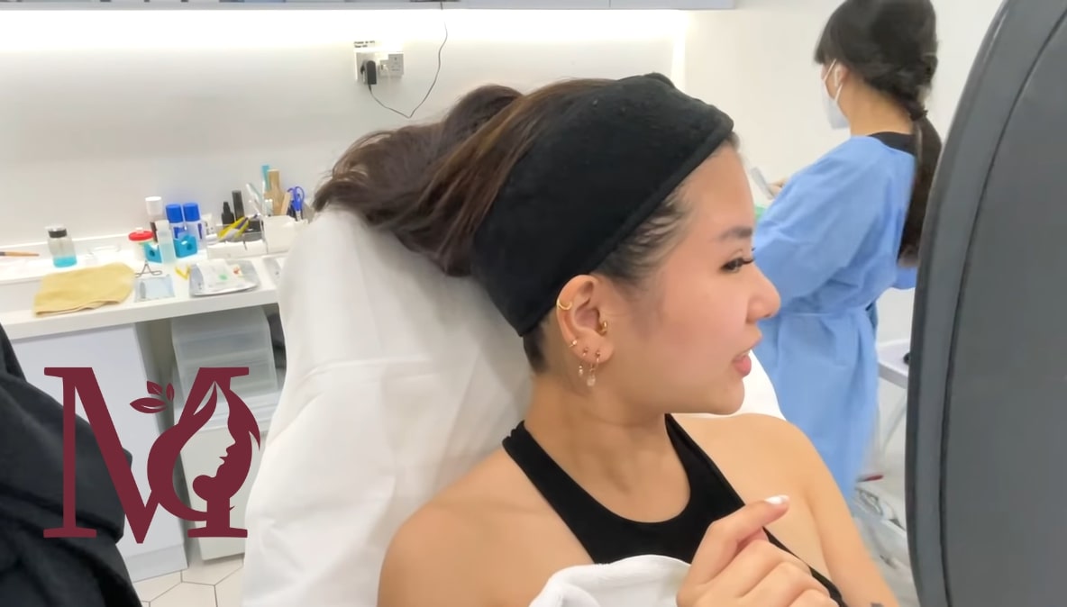 Top 5 Nose Thread Lift Clinics in Singapore