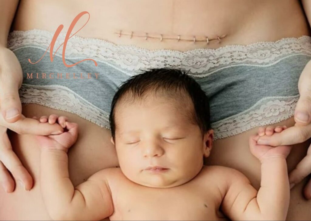 Post Cesarean Recovery Guide in Singapore [Massage Services + Tips]